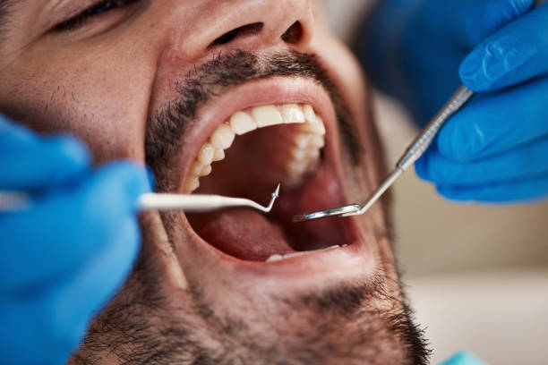 Emergency Dental Services in Emory, TX
